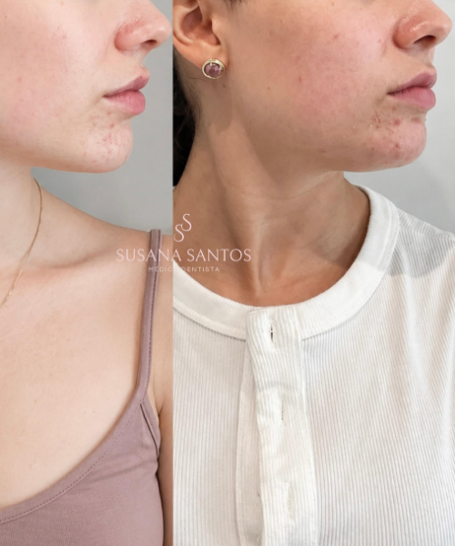 Harmonização Orofacial (10)