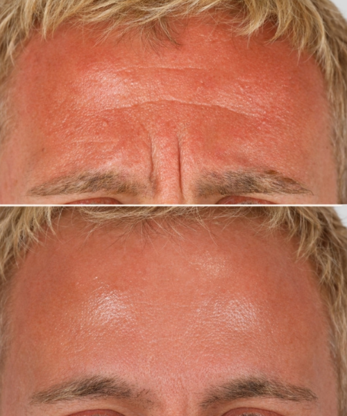 Harmonização Orofacial (3)