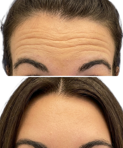Harmonização Orofacial (7)
