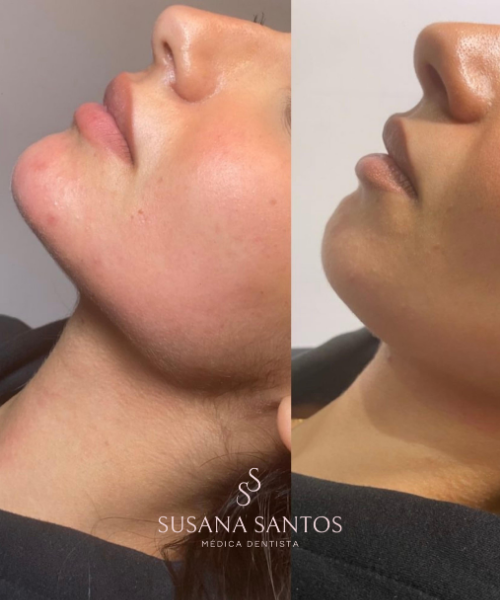 Harmonização Orofacial (9)