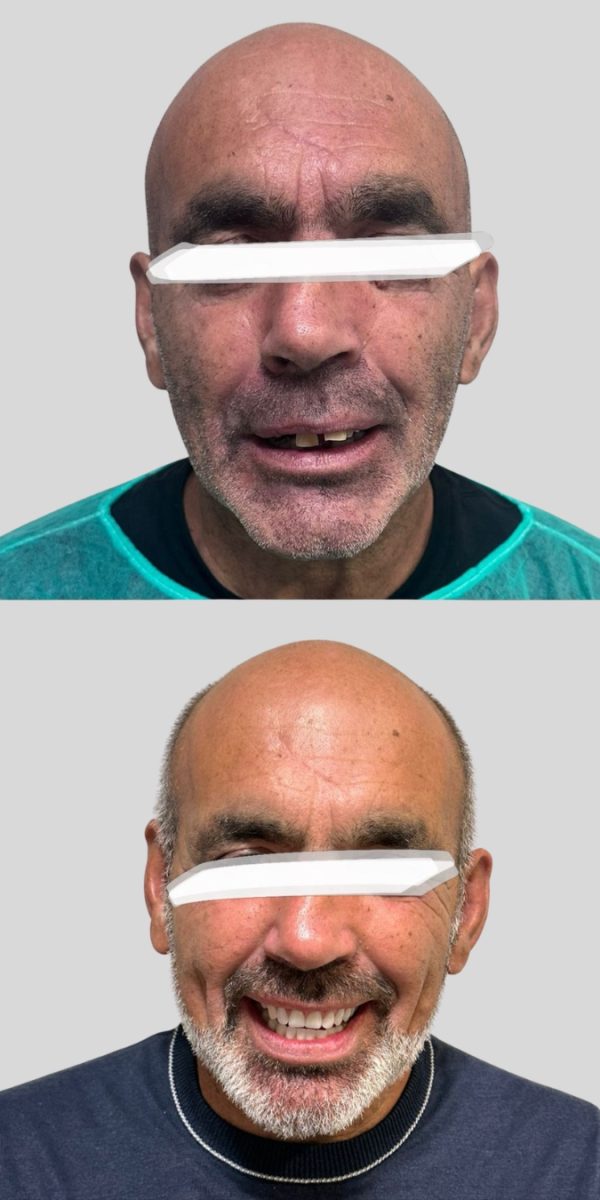 Caso clínico depois do tratamento dentário