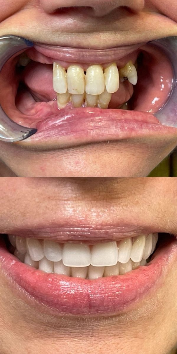 Caso clínico antes do tratamento dentário