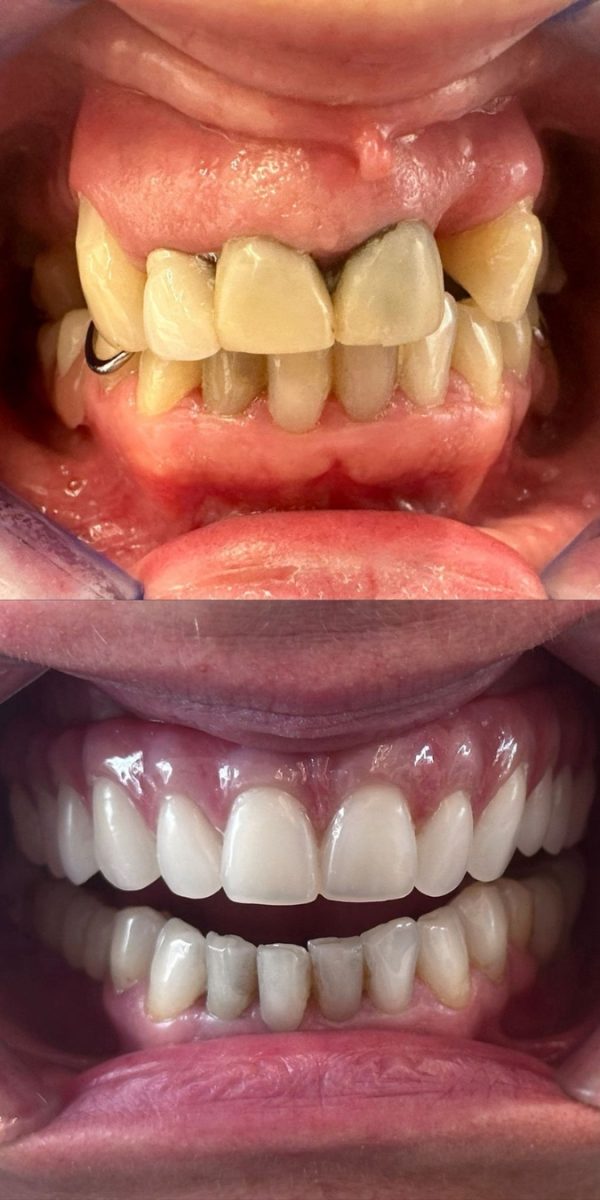 Caso clínico depois do tratamento dentário