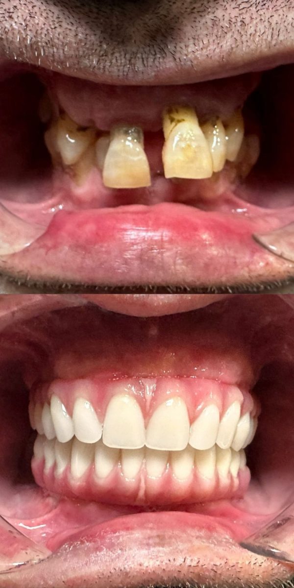 Caso clínico antes do tratamento dentário
